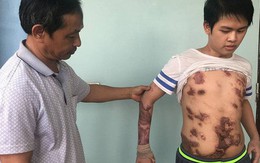 Cậu bé 16 tuổi sống sót sau vụ cháy xưởng bánh kẹo khiến 8 người tử vong ở Hà Nội bây giờ ra sao