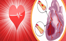 Cảm cúm nguy hiểm hơn bạn nghĩ, chuyên gia khuyến cáo nhóm người nhất định phải tiêm phòng