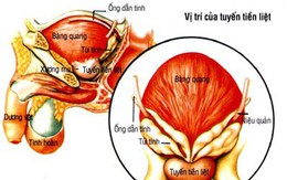 Bệnh tuyến tiền liệt – chớ coi thường!