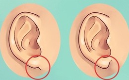 Nhìn tai bắt bệnh: Những dấu hiệu nguy hiểm bạn không ngờ