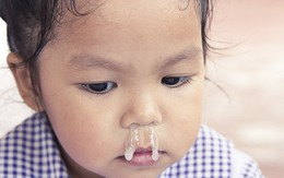 Các bác sĩ cảnh báo về cách chữa sổ mũi bằng tỏi ngâm nước muối sinh lý đang được các mẹ lan truyền