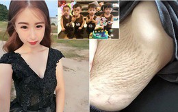 Mẹ trẻ xinh như hotgirl khoe ảnh vết rạn da chằng chịt sau khi sinh 4 con