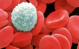 Bác sĩ Viện Huyết học và Truyền máu TƯ chỉ ra 6 dấu hiệu sớm của bệnh ung thư máu
