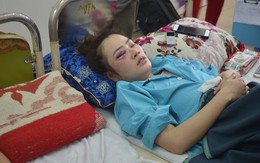 Thanh niên đánh cô gái nhập viện cấp cứu vì được ăn dĩa bánh xèo trước bị phạt 1,5 triệu