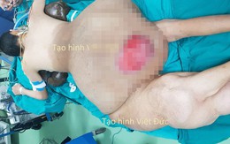 Bác sĩ "choáng" với khối u nặng 45 kg trên người nam thanh niên