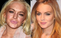 Lindsay Lohan tuổi 32: Nhan sắc già nhăn nheo trước tuổi, phải "chạy trốn" khỏi Hollywood