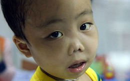 12 triệu người Việt, riêng Hà Nội nghi ngờ 10% học sinh mang gen bệnh tan máu bẩm sinh