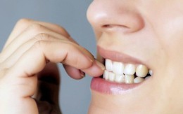 Đừng chủ quan, thói quen cắn móng tay có thể gây ra những hậu quả khôn lường cho sức khỏe mà bạn không ngờ tới