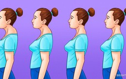 Nếu bạn quá buồn lòng vì bỗng nhiên dáng xấu đi do vai u, lưng còng, có bướu sau gáy thì hãy làm ngay 6 điều này