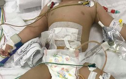 TP.HCM: Bé trai 11 tháng tuổi bị mẹ ruột dùng dao đâm nhiều nhát vào bụng nguy kịch