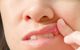 Một số vấn đề sức khỏe răng miệng không phải ai cũng biết