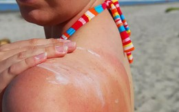 Bạn có thể hại da vì chống nắng sai cách