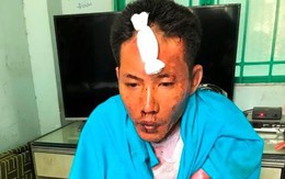 Bị đuổi ra khỏi nhà, người đàn ông mua xăng thiêu sống vợ và 2 con