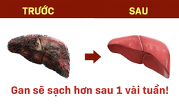 TS Mỹ tiết lộ 5 cách làm sạch gan: Số 5 rất đặc biệt nhưng người Việt lại dễ thực hiện