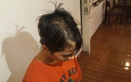 Thiếu nữ 14 tuổi bị nhóm thanh niên truy sát giữa khuya ở Sài Gòn
