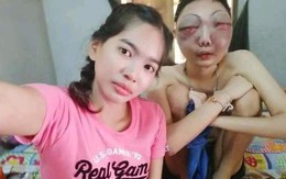 Yêu nhau lúc ngọt bùi nhưng không buông tay ngày giông bão - câu chuyện nóng MXH về tình yêu khiến triệu triệu trái tim rơi lệ