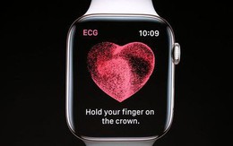 Điện tâm đồ là gì? Tại sao Apple lại đưa nó lên chiếc Apple Watch mới của mình? Nó hơn gì công nghệ cũ?