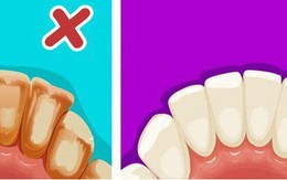 6 mẹo đơn giản giúp bạn có hàm răng trắng sáng