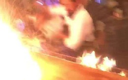 Nhà hàng biểu diễn quá tay, lửa táp thực khách bỏng nặng