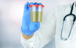 10 bí mật về nước tiểu liên quan đến thận, sức khỏe: Ai cũng nên biết rõ để phòng bệnh tốt