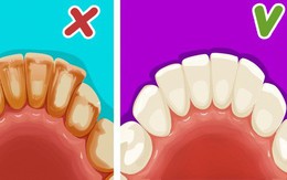 Ghi nhớ 6 mẹo đơn giản để có một hàm răng trắng như sứ