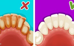 Ghi nhớ 6 mẹo đơn giản để có một hàm răng trắng như sứ