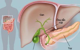 Gan mật - anh em song sinh trong lục phủ ngũ tạng: 4 điều cần biết để chăm sóc đúng