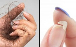 10 thay đổi trên cơ thể cảnh báo tình trạng sức khỏe mà bạn cần chú ý