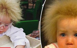 Kỳ lạ bé gái 8 tuổi có mái tóc 'dựng đứng' giống nhà bác học thiên tài Albert Einstein