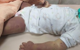 Bé gái bất ngờ ọc sữa rồi tử vong, kiểm tra thi thể em thì phát hiện nghi phạm không ai khác chính là người mẹ 17 tuổi