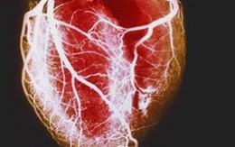 Nguyên nhân dẫn đến một cơn đau tim: Những điều bạn thực sự nên biết càng sớm càng tốt
