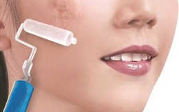 Hành tây xóa các loại sẹo và làm đẹp da