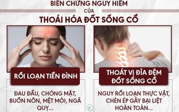 Thoái hóa đốt sống cổ: Nguyên nhân, triệu chứng và cách điều trị