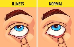 Bài kiểm tra sức khỏe đơn giản bạn có thể tự làm tại nhà để biết mình có bị 9 bệnh này hay không