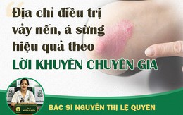 Cách chữa vảy nến, á sừng hiệu quả theo tư vấn bác sĩ trưởng khoa da liễu