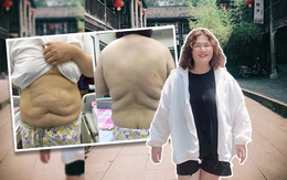 Biến mất 2 năm, hút 8 lít mỡ và hình ảnh hiện tại gây sốc của "hot girl ngàn cân" Thủy Tiên