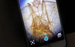 Phụ kiện độc đáo biến smartphone thành kính hiển vi, quan sát được cả vi khuẩn siêu nhỏ nhờ khả năng phóng đại gấp 1000 lần
