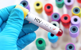 Chủng virus HIV mới phát hiện sau 20 năm có đáng sợ hay không?