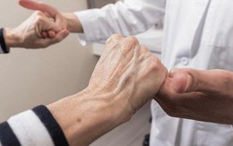 Thiên ma và Câu đằng: Bộ đôi thảo dược có tác dụng vượt trội trong hỗ trợ điều trị run chân tay