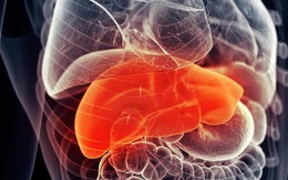 Nóng gan và những triệu chứng ảnh hưởng đến sức khỏe