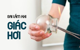 4 nhóm người không nên giác hơi: Nếu giác sai sẽ "bốc hơi" sức khỏe, rủi ro tính mạng