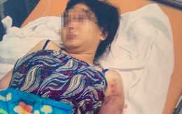 Cô gái bị đánh đến sẩy thai ở TP.HCM: Cô ve chai kể phút thấy bé sơ sinh trong túi rác