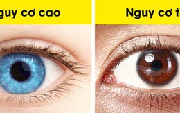 Đọc vị tính cách và sức khỏe qua ngoại hình: Dự đoán khối u ác tính qua đôi mắt