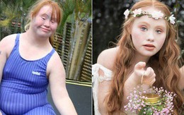 Người mẫu trẻ mắc bệnh Down từng thay đổi chuẩn mực cái đẹp thế giới 4 năm trước giờ đây đã có bước tiến không ngờ, mơ thành 'thiên thần Victoria's Secret'