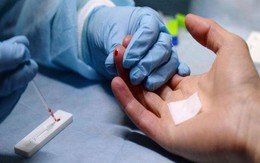 Chưa tạm giữ nghi phạm tấn công 10 người dân TP.HCM phải điều trị phơi nhiễm HIV