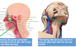 Sập giàn giáo rơi từ tầng 2 xuống, nạn nhân lưỡi gần đứt rời... được cứu sống