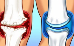 15 thực phẩm "thuốc" giúp khớp chắc khỏe: Đừng coi nhẹ việc tăng cường sức mạnh của khớp