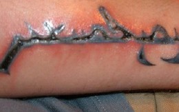 Hiệp hội sức khỏe Anh cảnh báo: Nên cấm người dưới 18 tuổi bơm môi vì lý do này