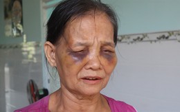 Bình Phước: Con dâu đánh mẹ chồng sưng mặt rồi lại ngồi xuống khóc lóc xin lỗi