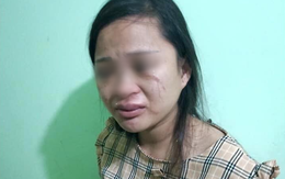 Mua đôi giày 135 ngàn, thai phụ 8 tháng bị mẹ chồng nói theo trai rồi xúi con đánh chảy máu mắt, bầm tím người